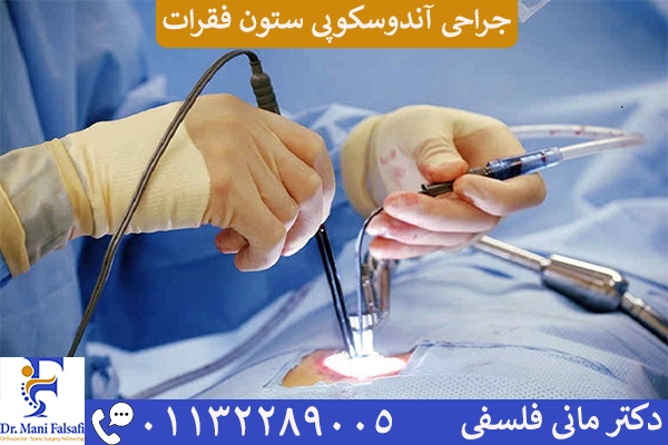 جراحی آندوسکوپی ستون فقرات