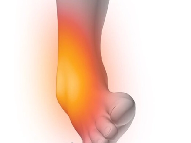 جراحی دفورمیتی مچ پا