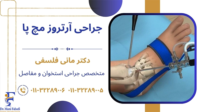 جراحی آرتروز مچ پا