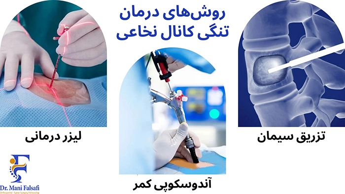 روشهای درمان تنگی کانال نخاعی