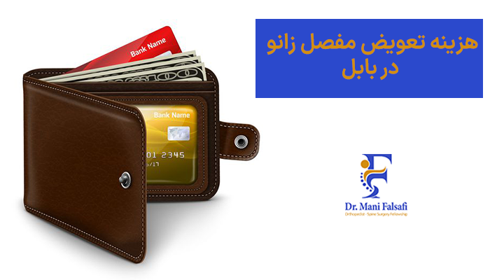 هزینه تعویض مفصل زانو در بابل