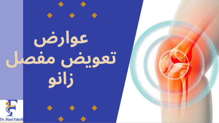 عوارض تعویض مفصل زانو
