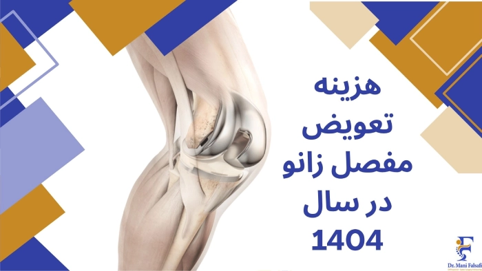 هزینه تعویض مفصل زانو