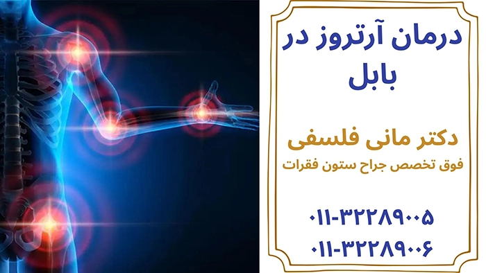 درمان آرتروز در بابل