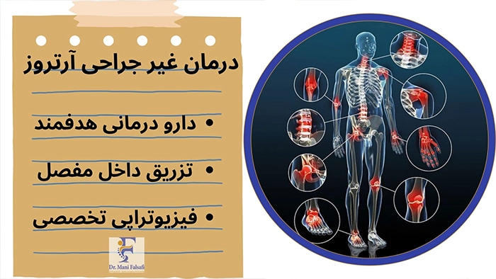 درمان غیرجراحی آرتروز