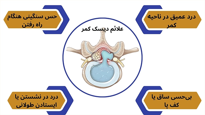 چگونه بفهمیم دیسک کمر داریم