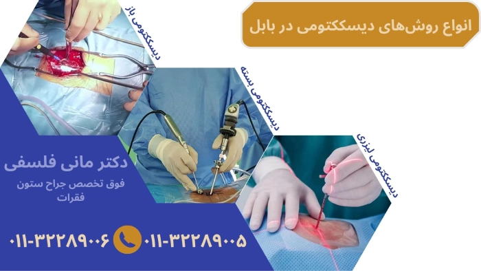 انواع روش های برداشتن دیسک کمر