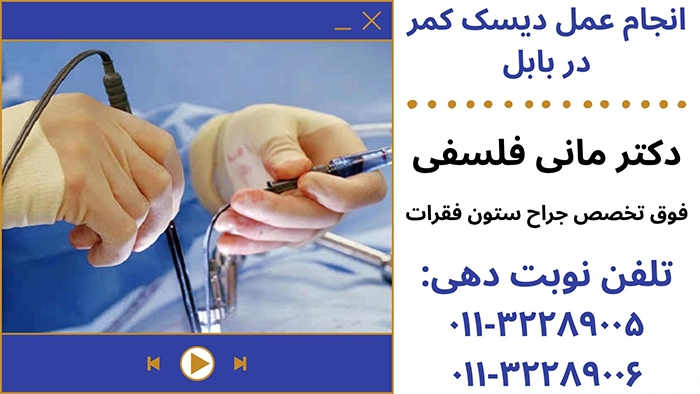 عمل دیسک کمر با لیزر در بابل
