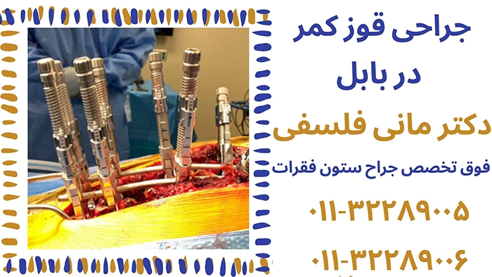 جراحی قوز کمر در بابل
