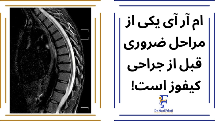 ام آر آی کیفوز