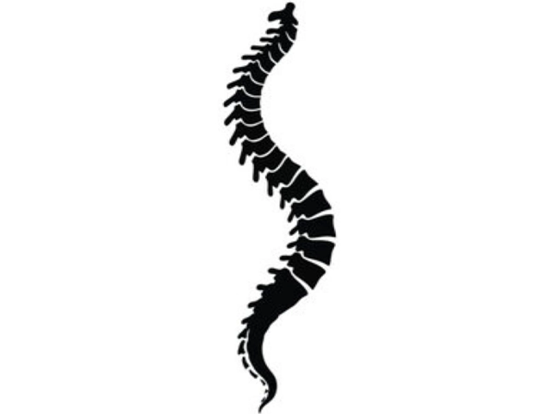 جراحی کیفوز