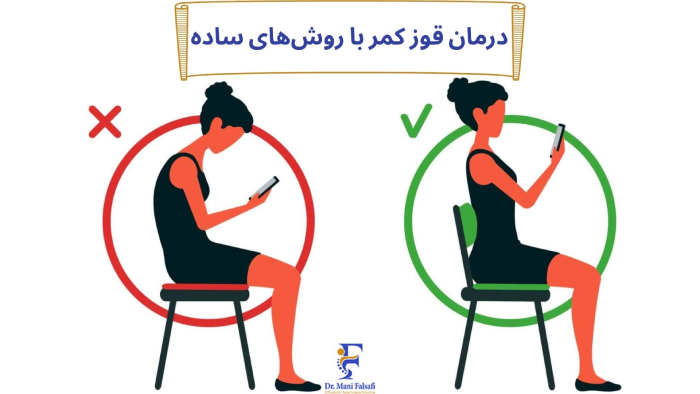 درمان قوز کمر خانگی