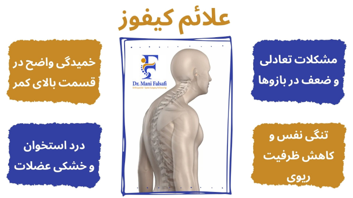 علائم کیفوز