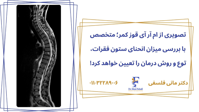ام آر آی کیفوز