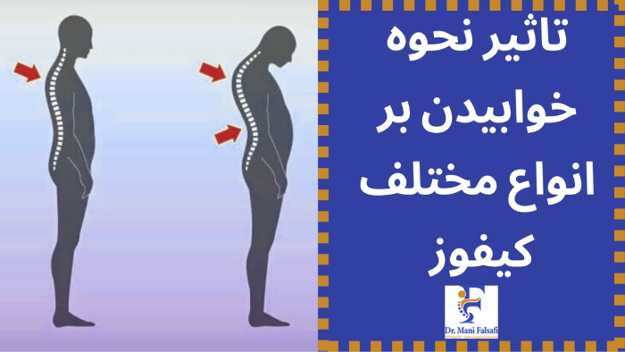 تاثیر خوابیدن بر قوز کمر