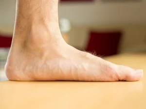 عوارض کف پای صاف