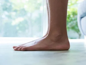 جراحی کف پای صاف