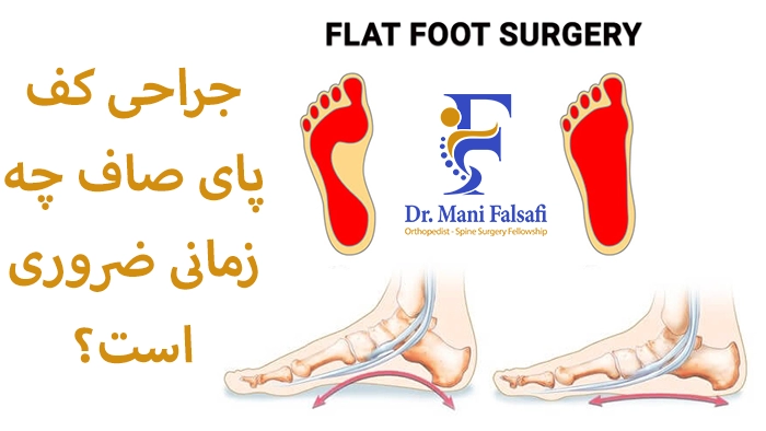 جراحی کف پای صاف