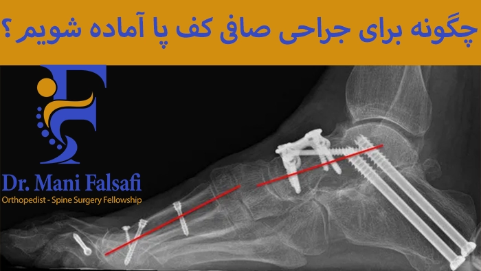 آمادگی قبل از جراحی کف پا صاف
