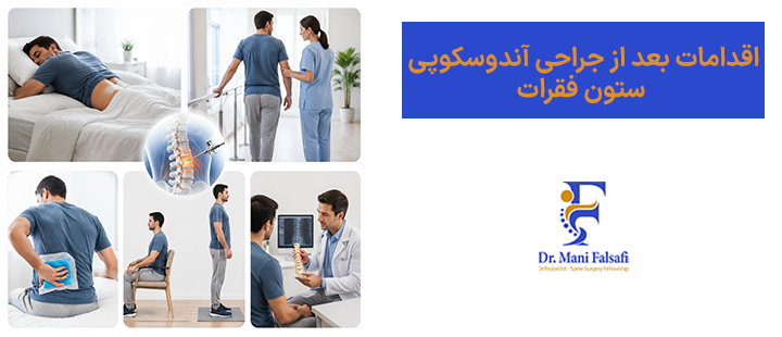 اقدامات بعد از جراحی آندوسکوپی
ستون فقرات
