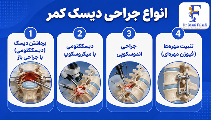 انواع جراحی دیسک کمر