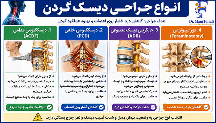 انواع جراحی دیسک گردن