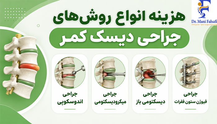 هزینه انواع روش های جراحی دیسک کمر