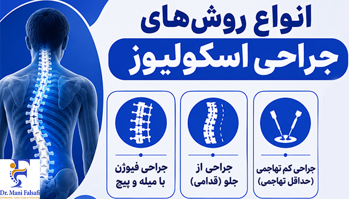 انواع روش های جراحی اسکولیوز