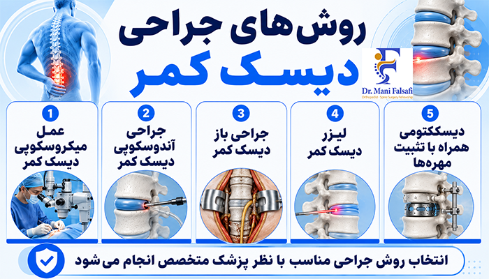 روش های جراحی دیسک کمر