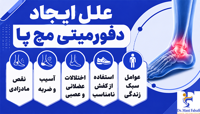 علل ایجاد دفورمیتی مچ پا